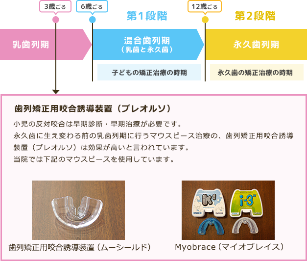 プレオルソ