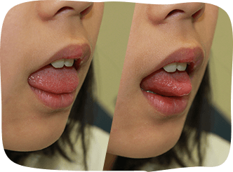 舌の形を変える