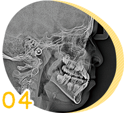頭部X線規格写真を使用した精密な診査・診断 