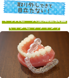 インビザライン